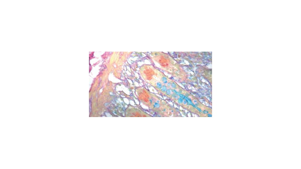 Diagnostic Biosystems Colloidal Iron Kit 100RXN KT 007