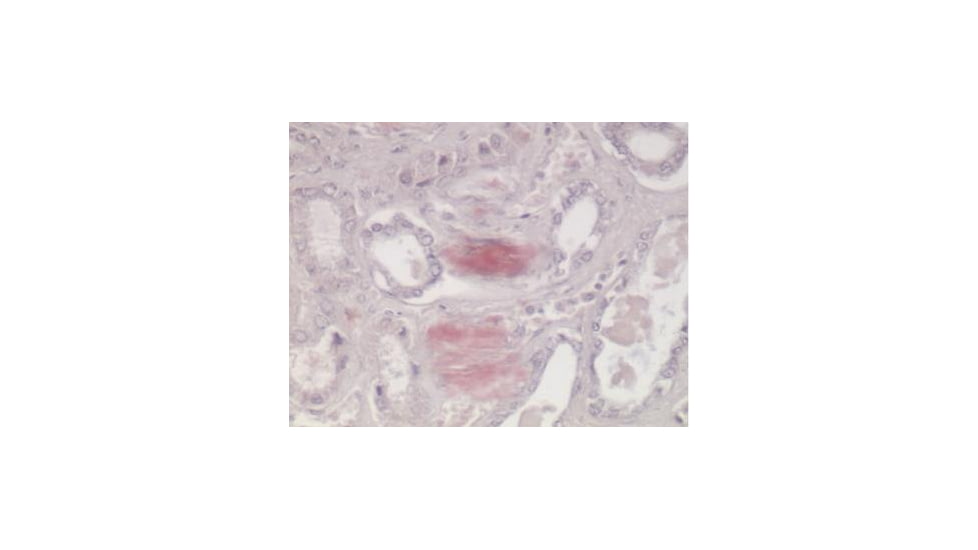 Diagnostic Biosystems Congo Red Kit 100RXN KT 008