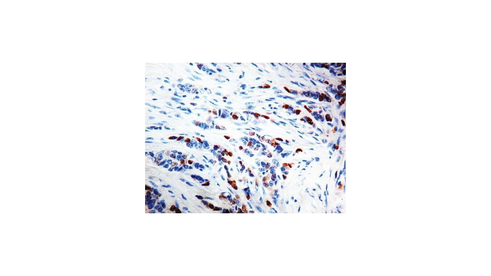Diagnostic Biosystems Cyclin D1 Clone BV2 RMPD 023
