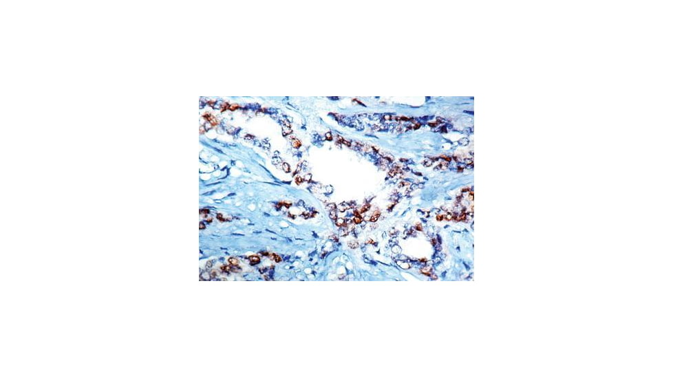 Diagnostic Biosystems Cyclin D1 - Clone DCS-6 .5ML MOB 178-05