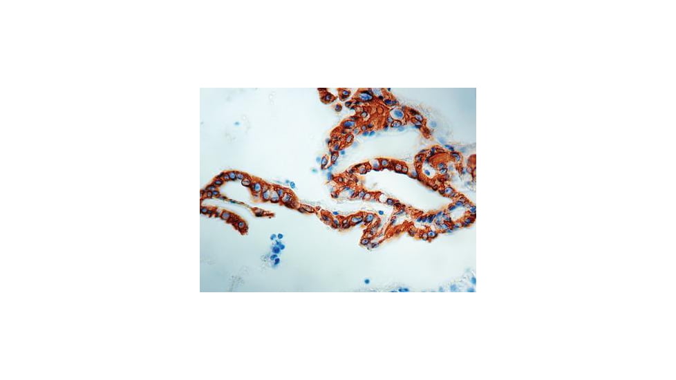 Diagnostic Biosystems Cytokeratin 8 CONC. Mab MOB 054