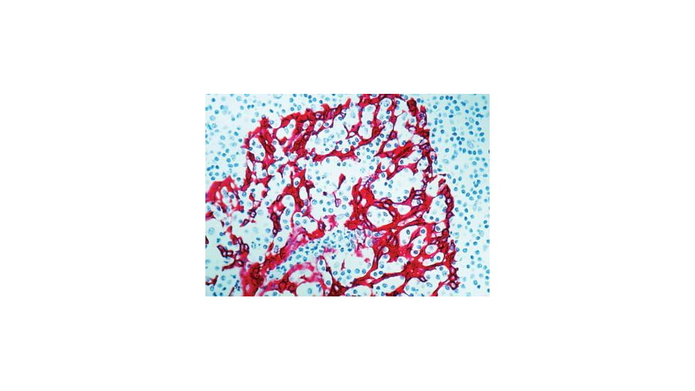 Diagnostic Biosystems Cytokeratin H.M.W. DE-SQ .5ML MOB 275-05