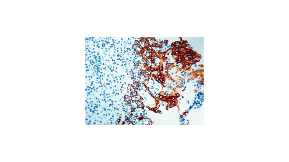 Diagnostic Biosystems Cytokeratin Pan CONC. Mab MOB 108