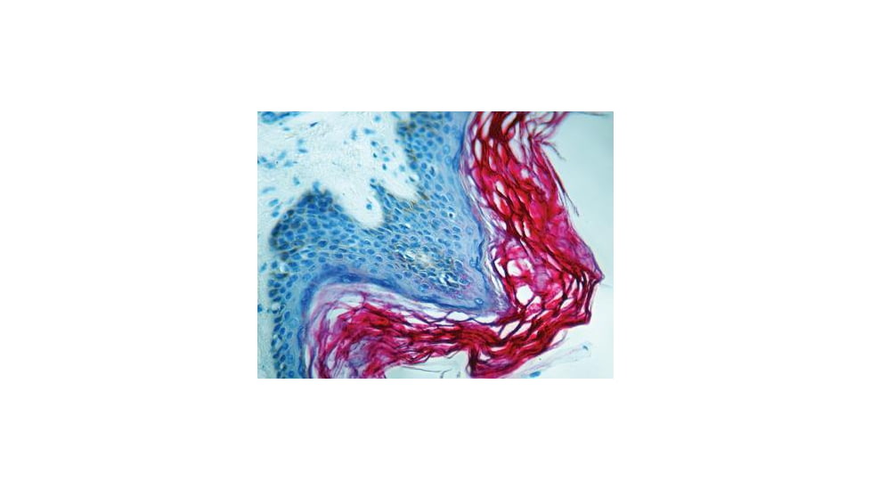 Diagnostic Biosystems Cytokeratin Pan CONC. Mab MOB 191