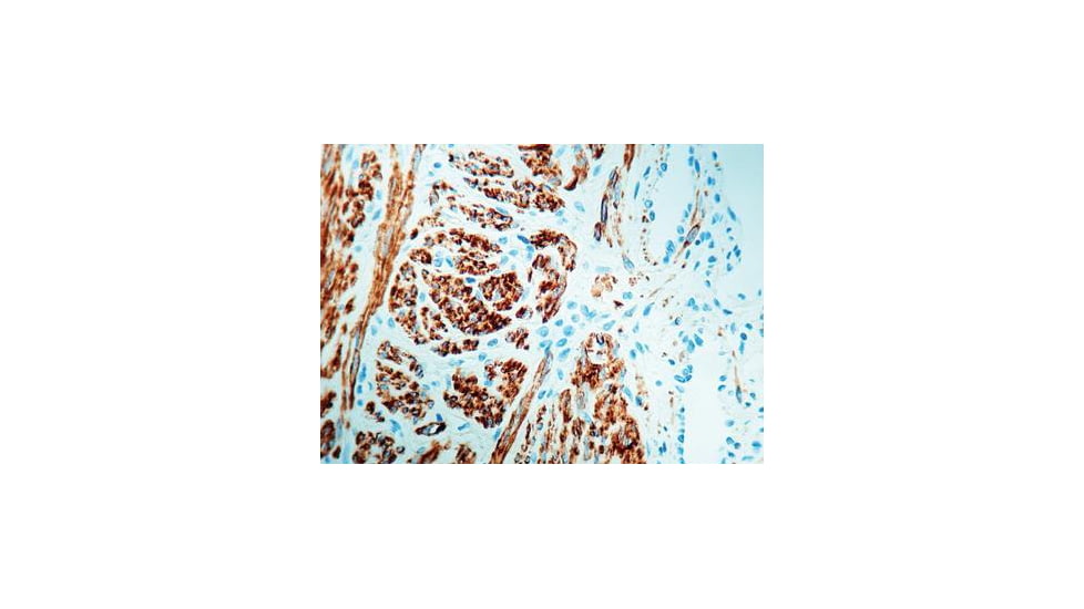 Diagnostic Biosystems Desmin CONC. Polyclonal Ab RP 011