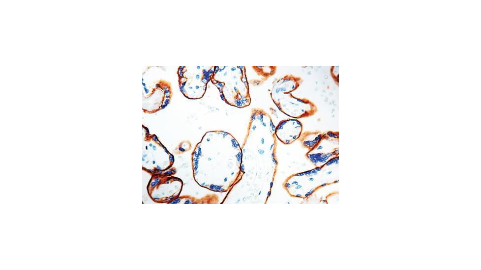 Diagnostic Biosystems Egfr - Clone SP9 1ML RMAB 020