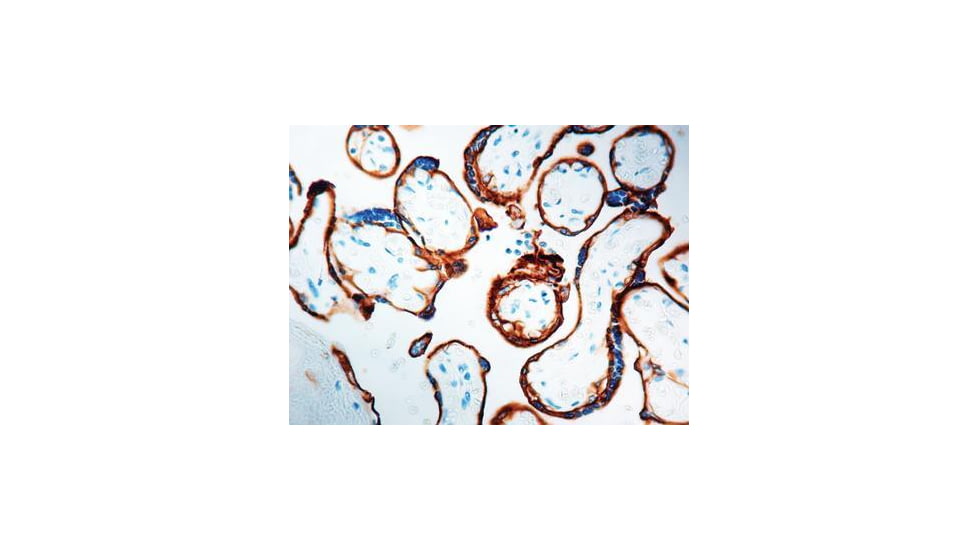 Diagnostic Biosystems Egfr CONC. Mab MOB 267