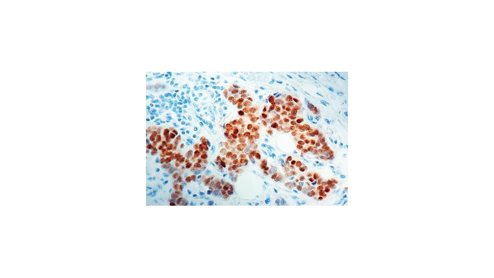 Diagnostic Biosystems Estrogen Receptor Rabbit .5ML RP 141-05