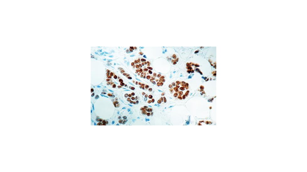 Diagnostic Biosystems Estrogen Receptor CONC. Mab MOB 121
