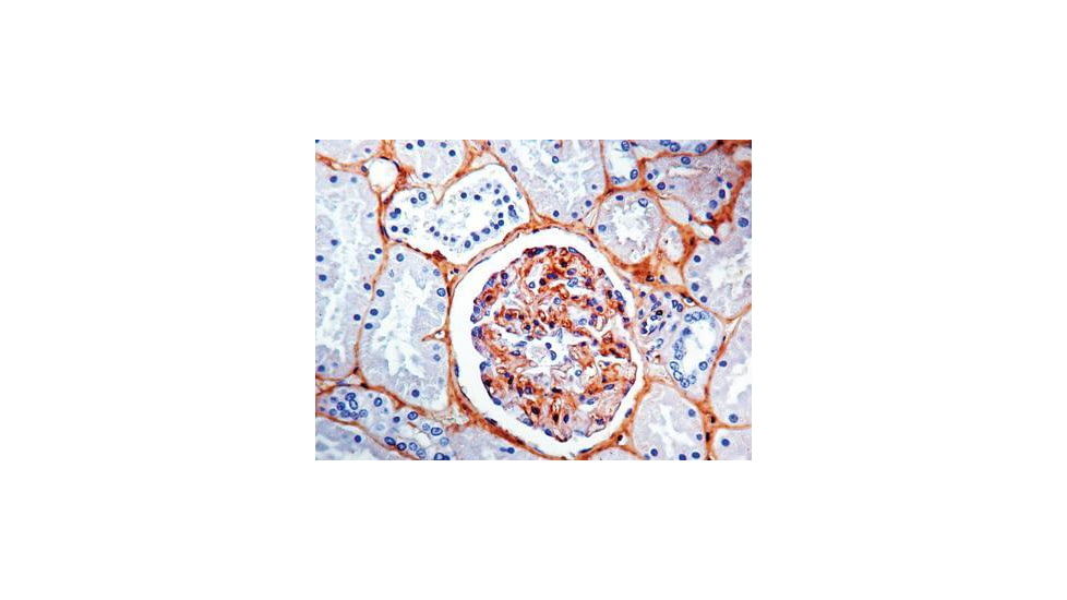 Diagnostic Biosystems Fibronectin CONC. Mab MOB 300