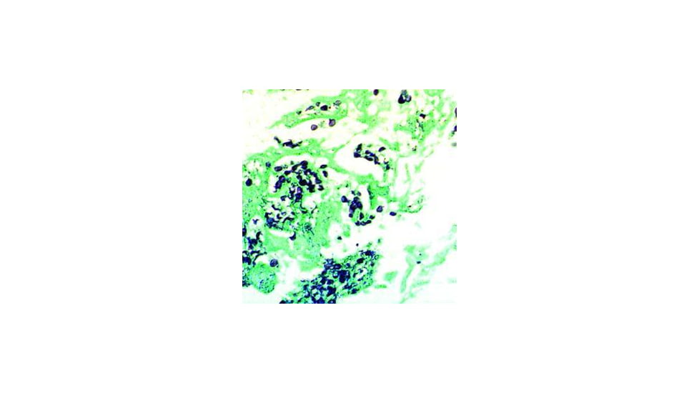 Diagnostic Biosystems G.M.S. Kit 100RXN KT 015