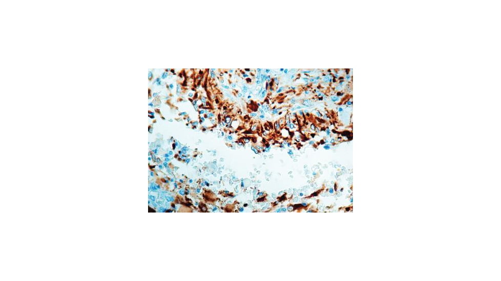 Diagnostic Biosystems Gfap CONC. Polyclonal Ab RP 014