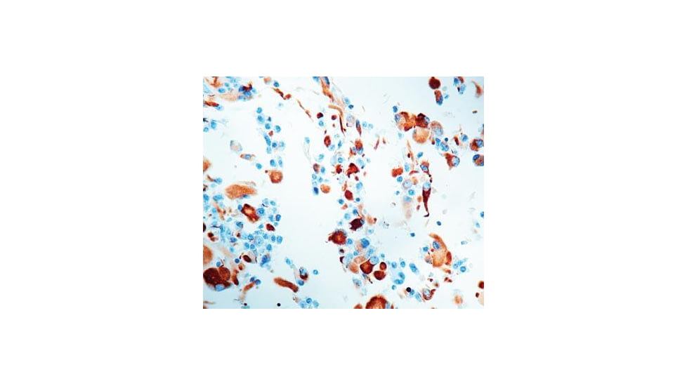 Diagnostic Biosystems Gfap CONC. Mab MOB 199