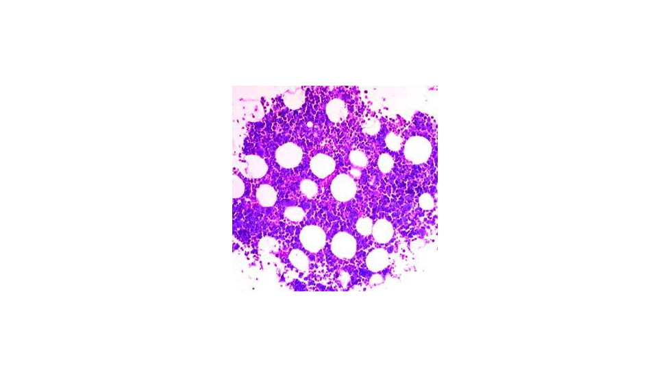 Diagnostic Biosystems Giemsa Kit 100RXN KT 016