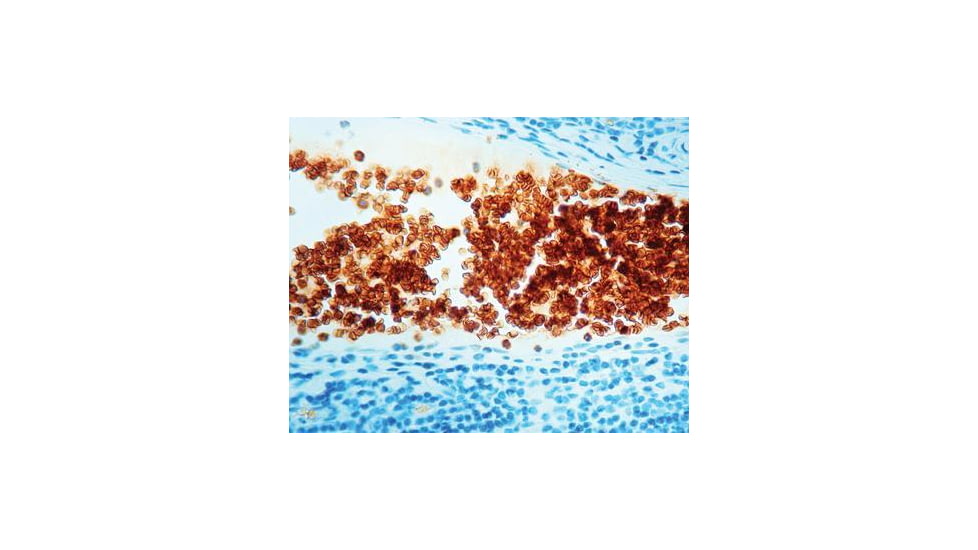 Diagnostic Biosystems Glycophorin A Clone JC159 .5ML MOB 066-05