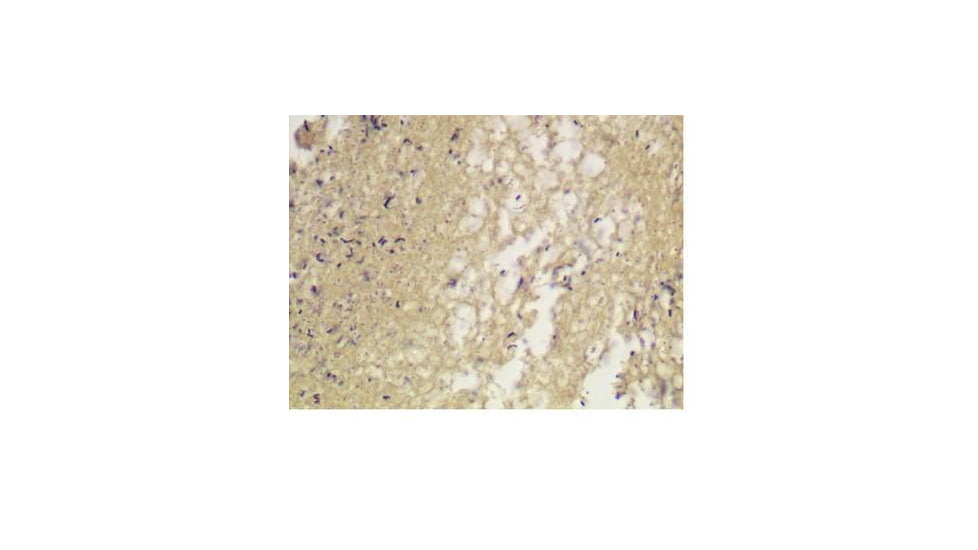 Diagnostic Biosystems Gram MCDONALDS Kit 100RXN KT 018