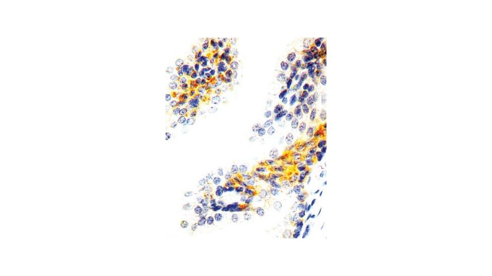 Diagnostic Biosystems Heregulin - Clone 7D5 .5ML MOB 343-05