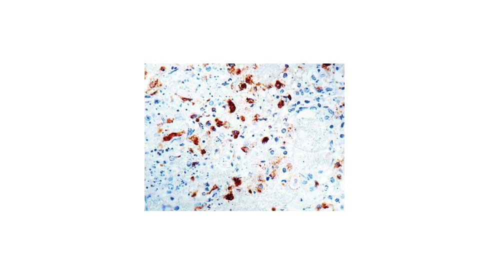 Diagnostic Biosystems Hsv Type Ii Rtu Mab PDM 081