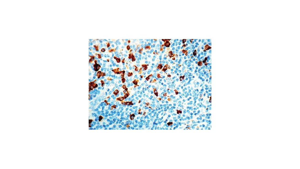 Diagnostic Biosystems Iga CONC. Polyclonal Ab RP 020