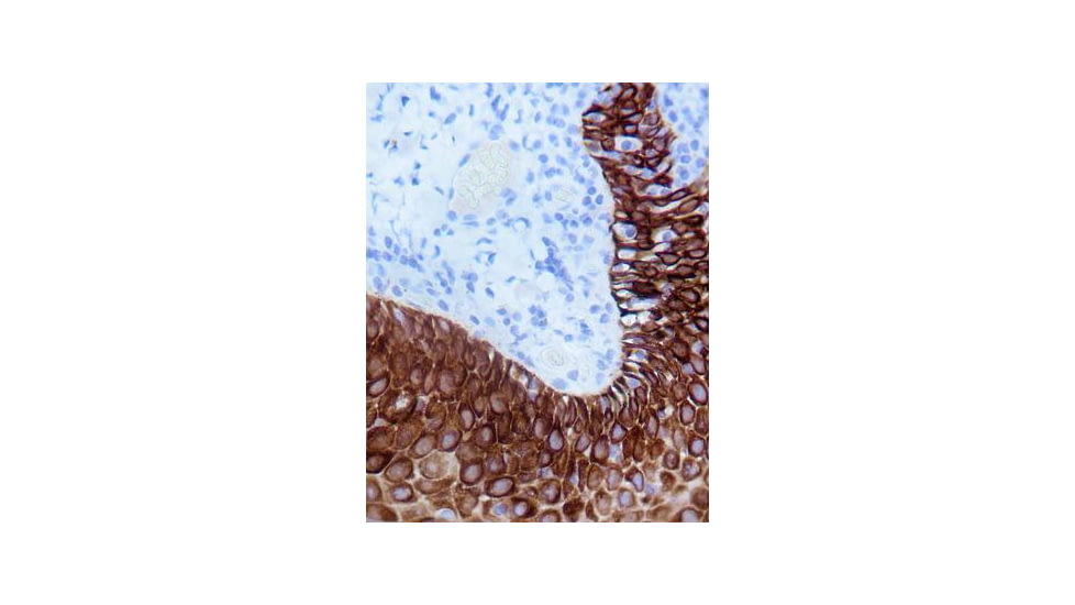 Diagnostic Biosystems INTENSI/FIRE 15ML K 045