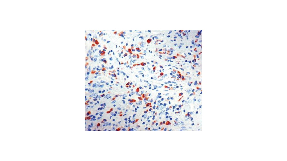 Diagnostic Biosystems Kappa Light Chain CONC. Mab MOB 075-01