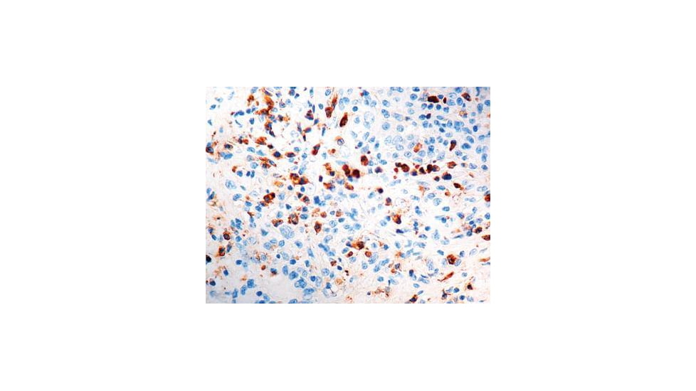 Diagnostic Biosystems Kappa Light Chain Rtu Pab PDR 015