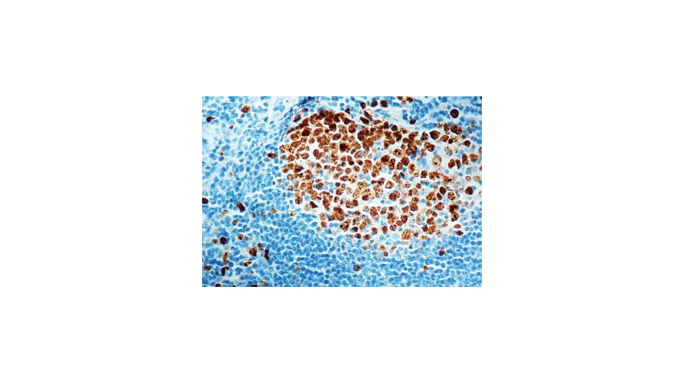 Diagnostic Biosystems KI-67 Antigen CONC. Mab MOB 237