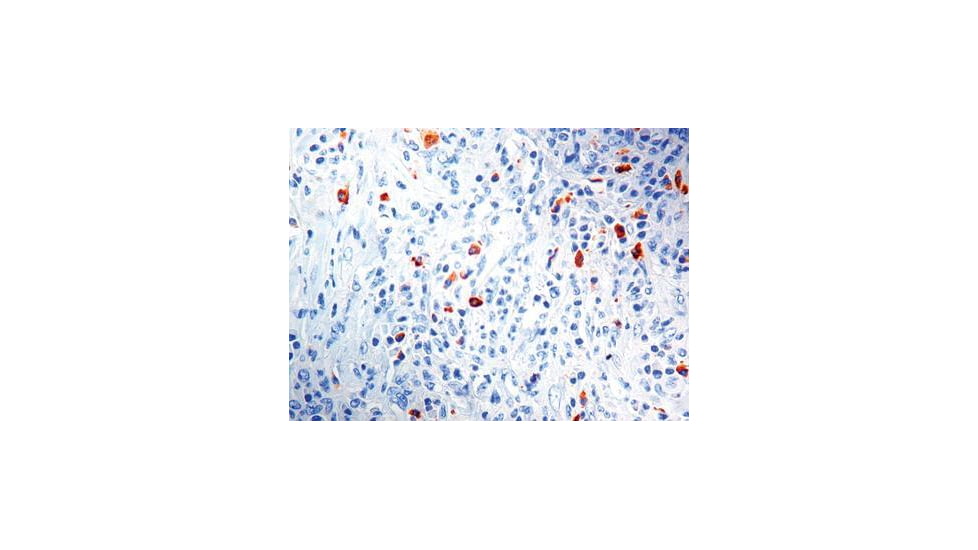 Diagnostic Biosystems Lambda Light Chain CONC. Mab MOB 201