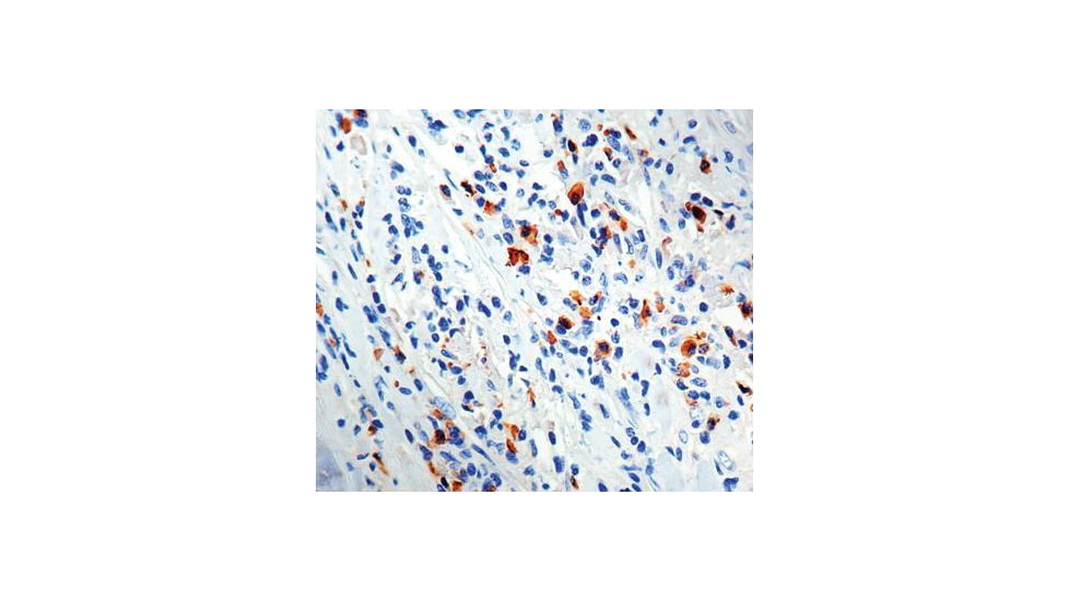 Diagnostic Biosystems Lambda Light Chain Rabbit .5ML RP 027-05