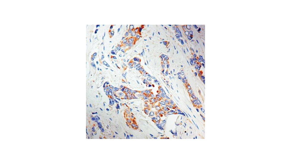 Diagnostic Biosystems LRP/MVP - Clone 1032 .5ML MOB 344-05