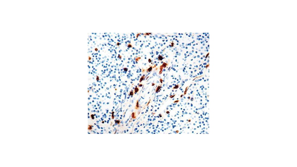Diagnostic Biosystems Macrophage - Clone MAC387 .5ML MOB 203-05
