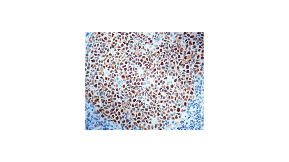Diagnostic Biosystems MSH2 - Clone 25D12 .5ML MOB 332-05