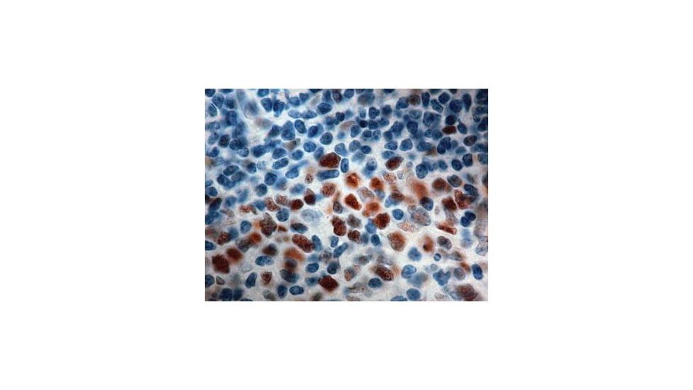 Diagnostic Biosystems MSH6 Clone 44 PDM 147