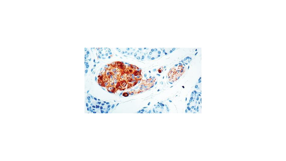 Diagnostic Biosystems Neuron Specific Enolase Mab MOB 212