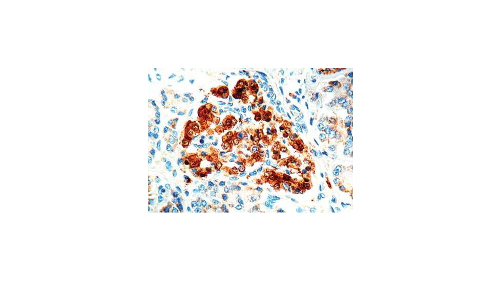 Diagnostic Biosystems Nse Rtu Polyclonal Ab PDR 006