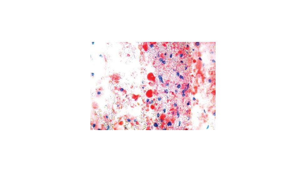 Diagnostic Biosystems Oil Red O Kit 100RXN KT 025