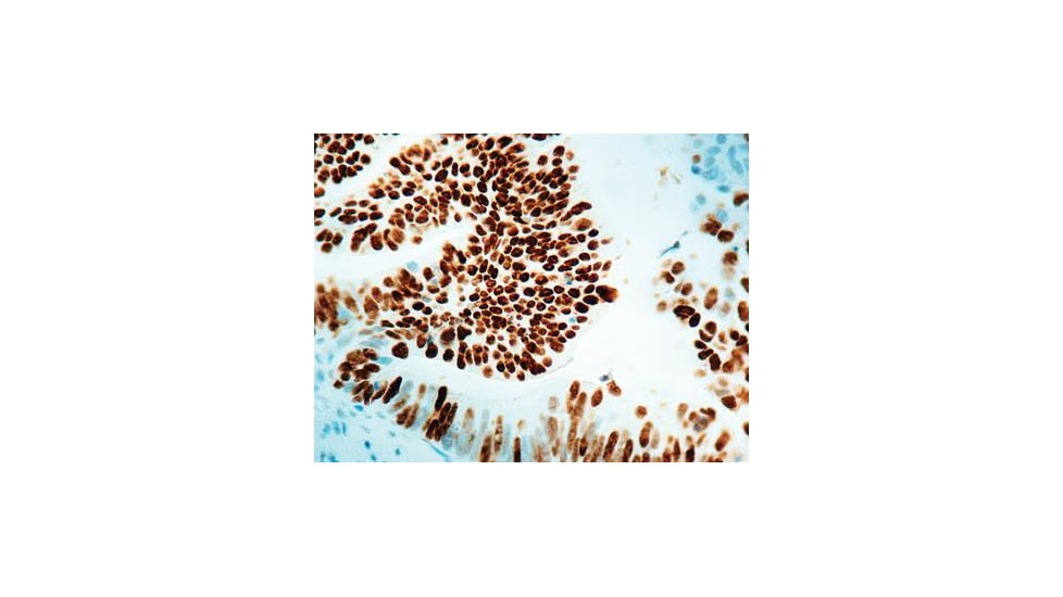 Diagnostic Biosystems P53 Protein - Clone DO7 .5ML MOB 082-05