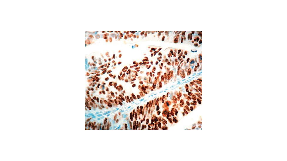 Diagnostic Biosystems P53 Rtu Mab PDM 035