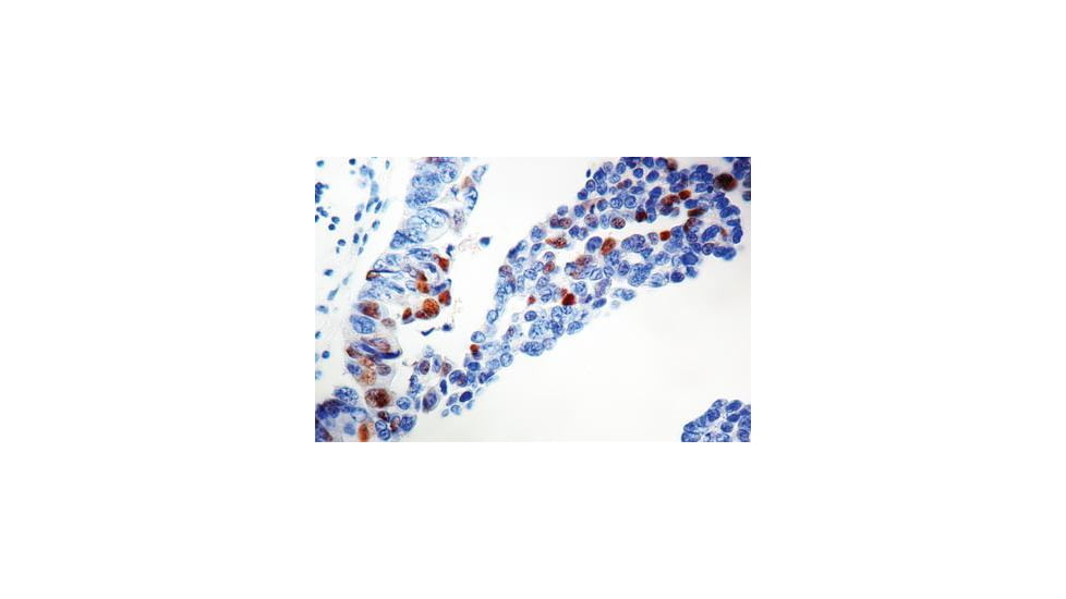 Diagnostic Biosystems P57KIP2 CONC. Mab MOB 291