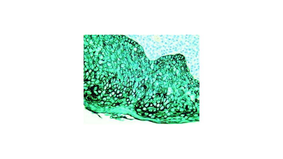 Diagnostic Biosystems PERMAGREEN/AP K 052