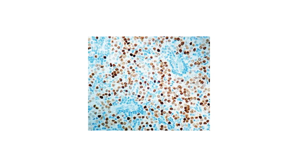 Diagnostic Biosystems Progesterone Receptor Rab .5ML RP 146-05
