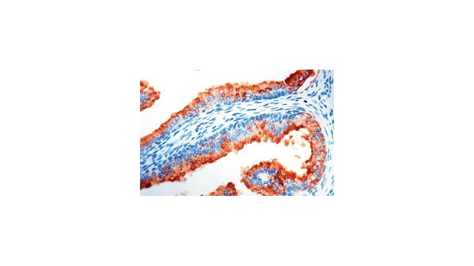 Diagnostic Biosystems Psa Rtu Polyclonal Ab PDR 007