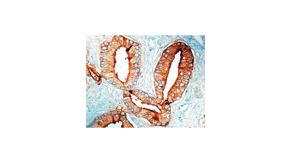 Diagnostic Biosystems Psap CONC. Mab MOB 085