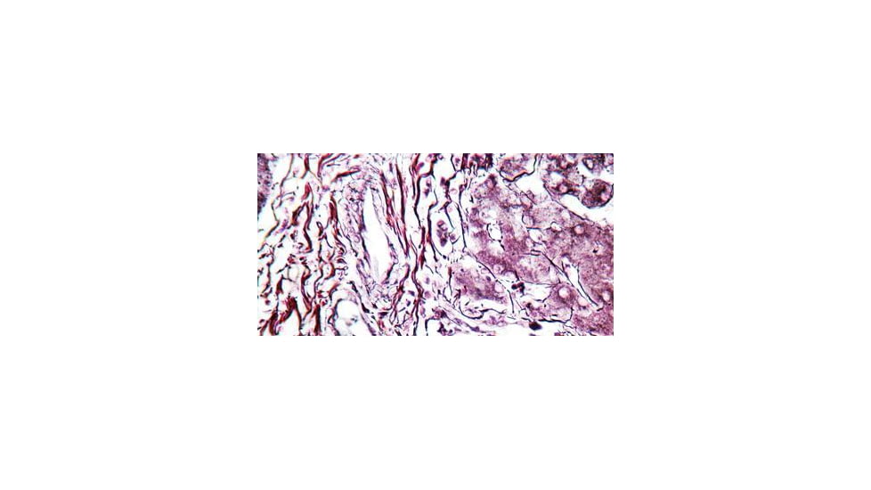 Diagnostic Biosystems Reticulum CHANDLERS Kt 100RXN KT 031