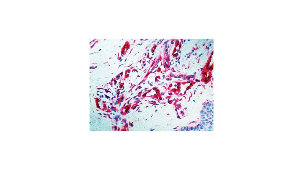 Diagnostic Biosystems S-100 - Rabbit .5ML RP 035-05