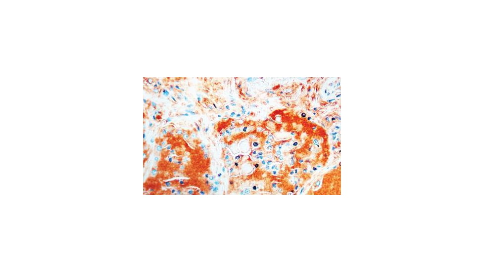 Diagnostic Biosystems Thyroglobulin - Clone 1D4 .5ML MOB 223-05