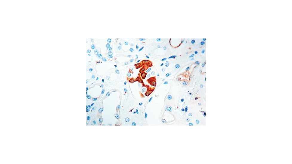 Diagnostic Biosystems Vegf - Rabbit .5ML RP 121-05