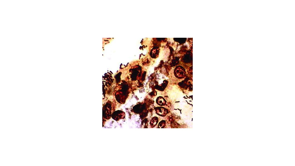 Diagnostic Biosystems WARTHIN-STARRY Kit 100RXN KT 036